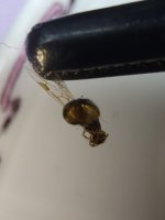 AbdomenİçiSol1.jpeg