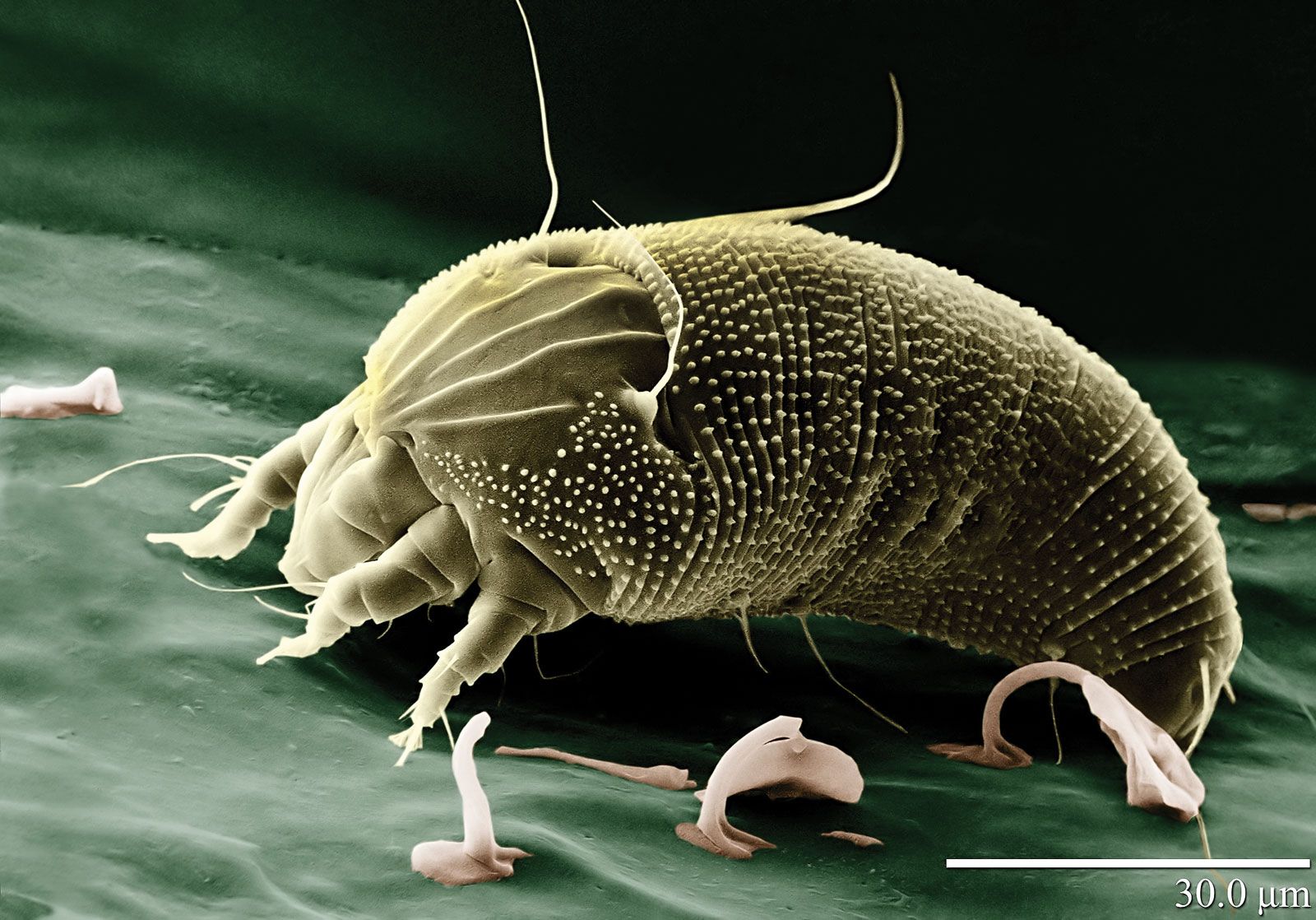 Scanning-electron-micrograph-rust-mite.jpg